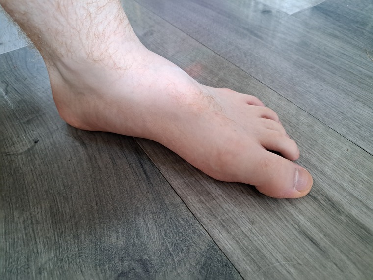 TOEby or not TOEby banner image