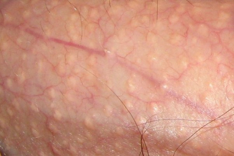 Too Much Skin cover image