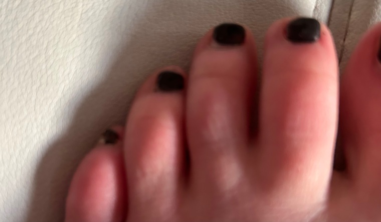 TinyToes25 cover image