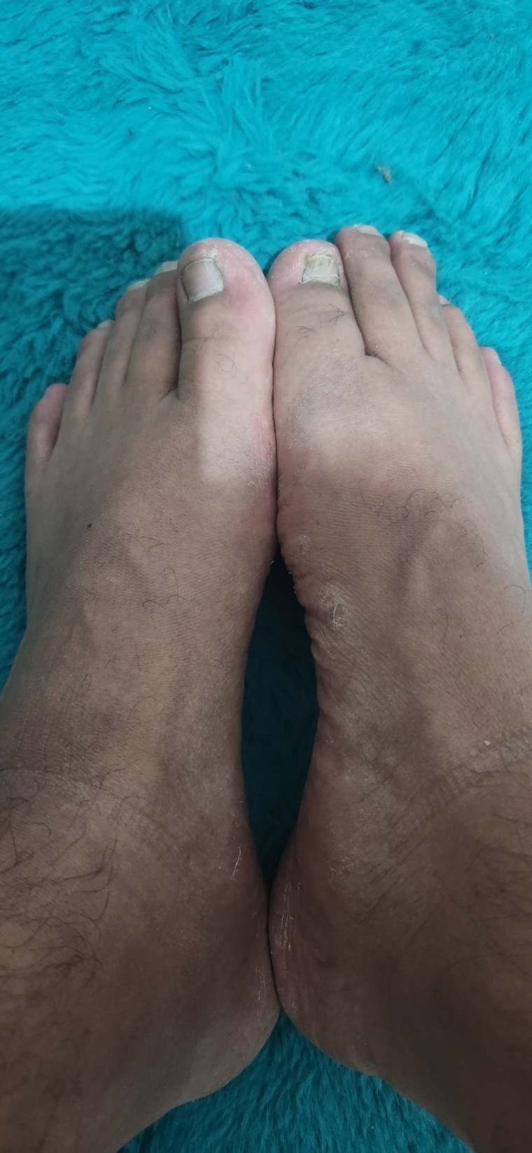 Foot and pies banner image