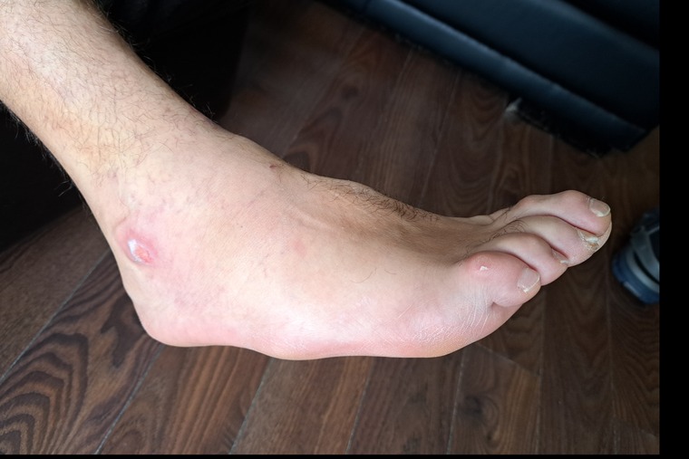 Ugly feet banner image