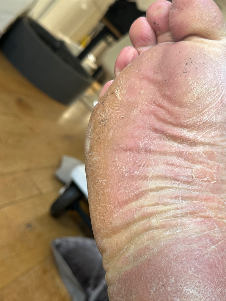 RugbyFeet cover image