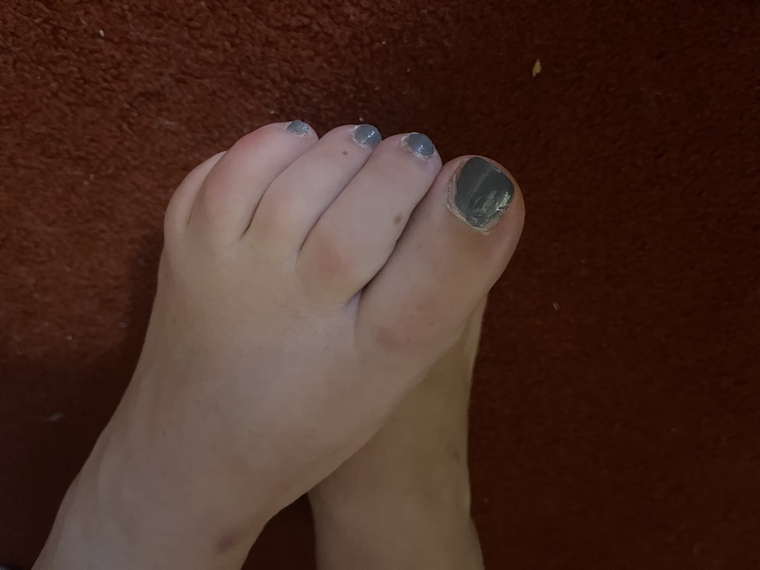 OnlyToes cover image