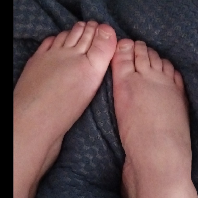 Bettie bunion banner image
