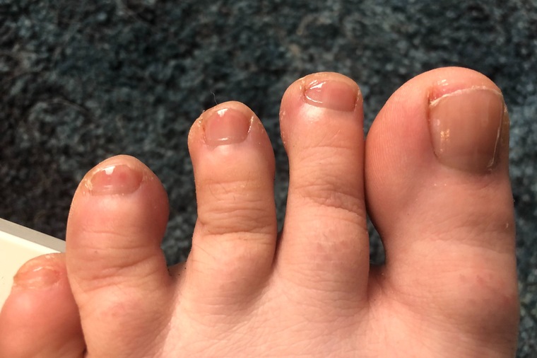 Sugarfeet cover image