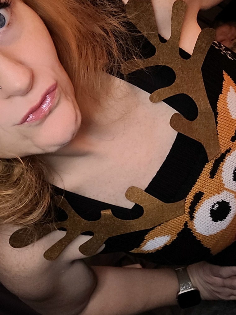 Sexy Freckles banner image