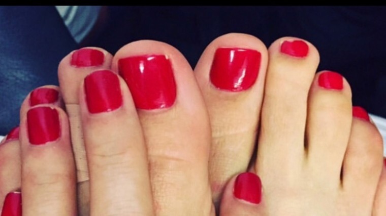 Myfeet cover image