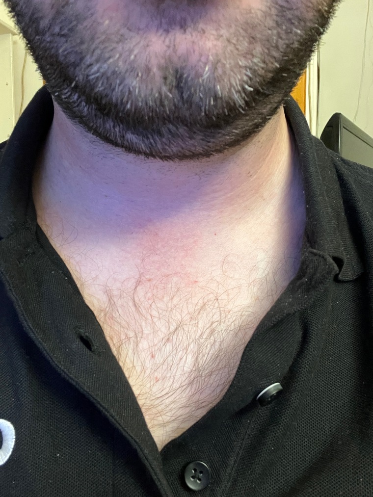 ChubbyDane cover image