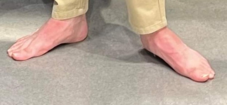 Man Feet cover image