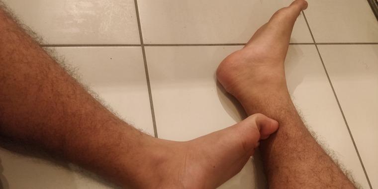 MyFeet cover image