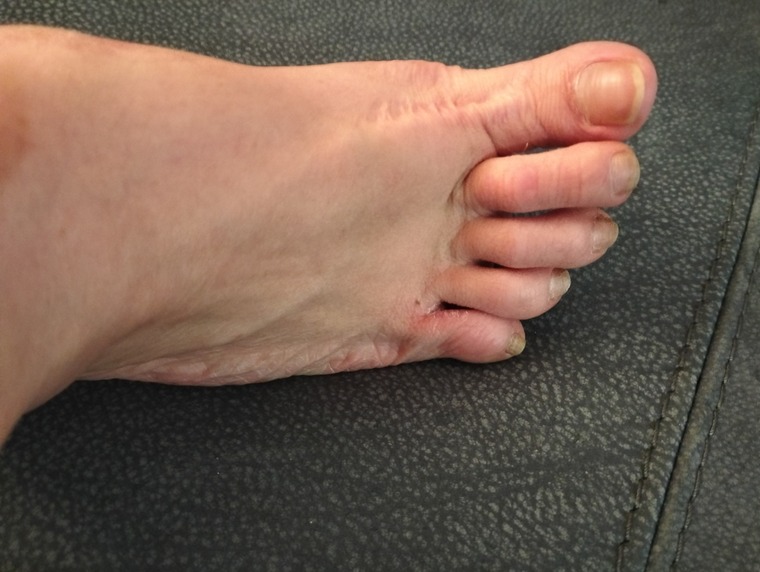 Kookyfootfingers cover image