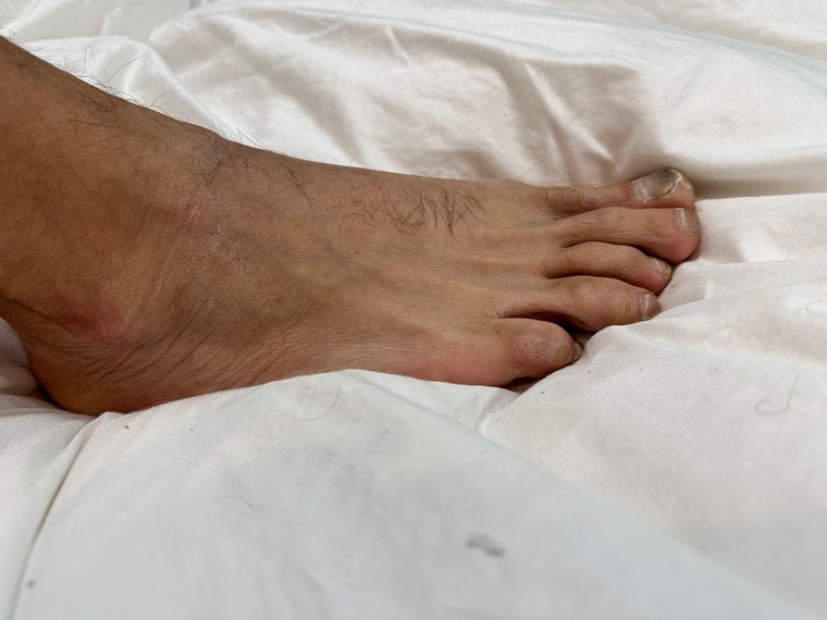 Feet and fetish cover image