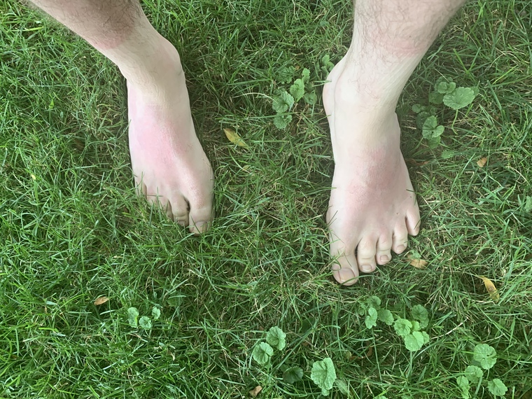 Feet forest banner image
