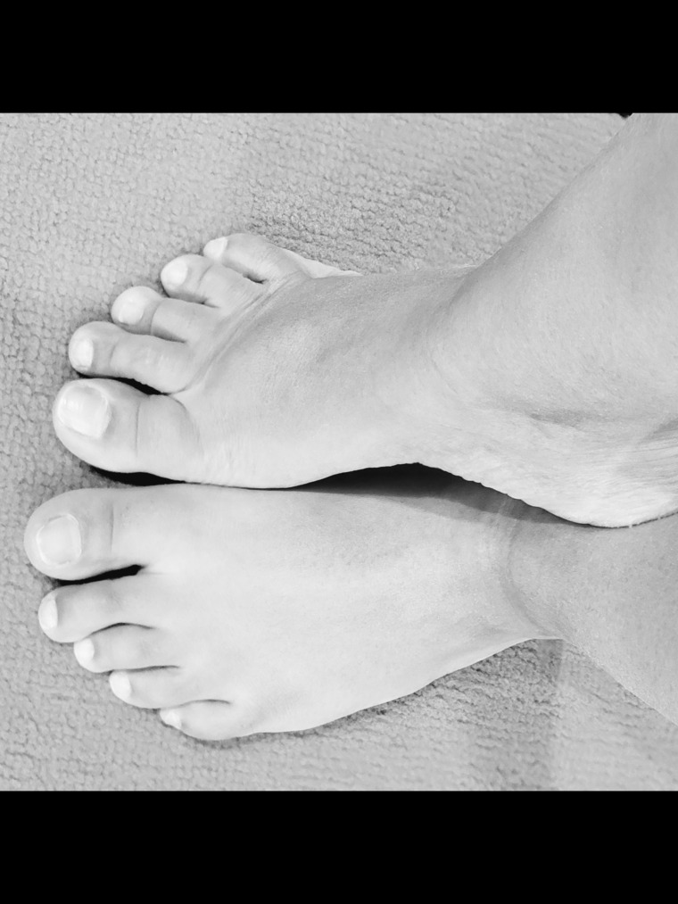 Prime feet cover image