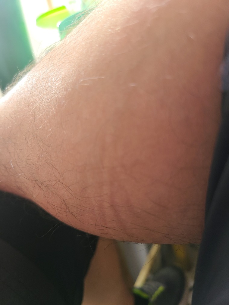 Piedri banner image