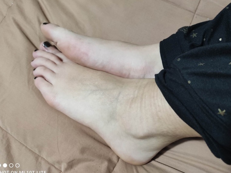 feet and flanks banner image