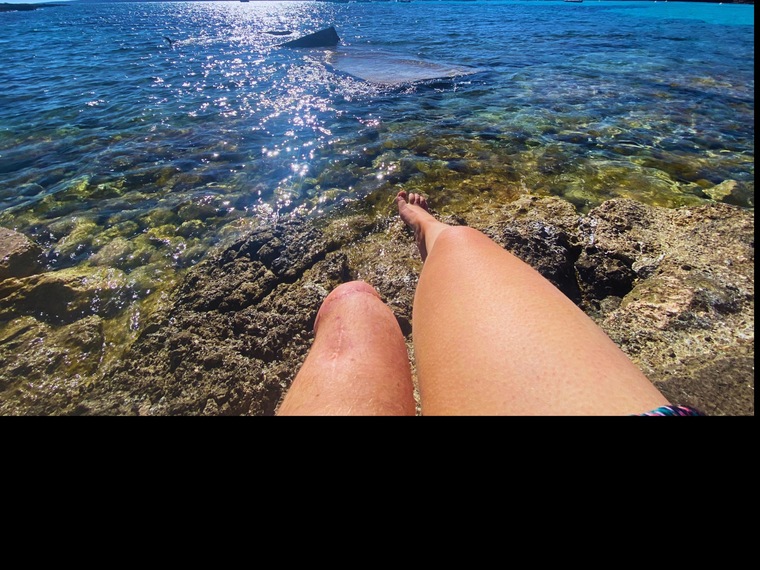 amputeemodel cover image