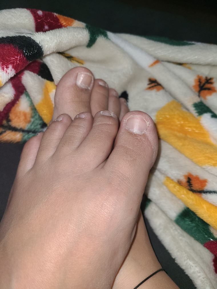 Uglyfeet cover image