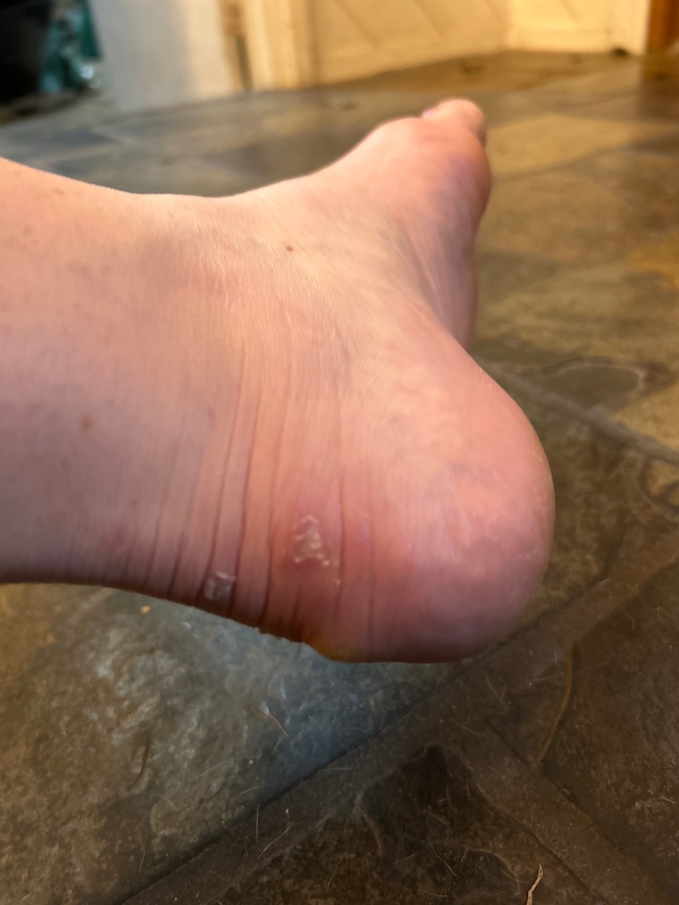 ScarredHeels banner image
