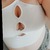 Opennurse avatar