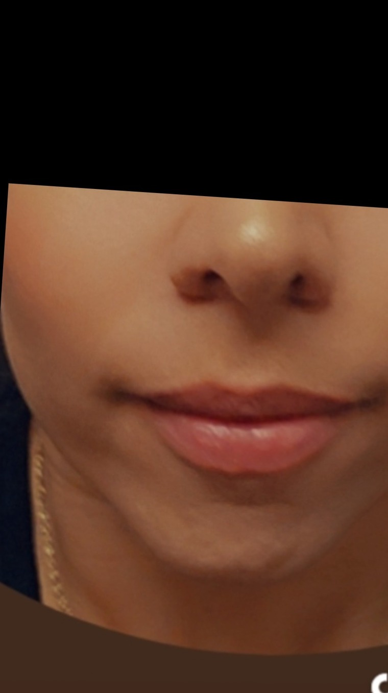 Marce cover image