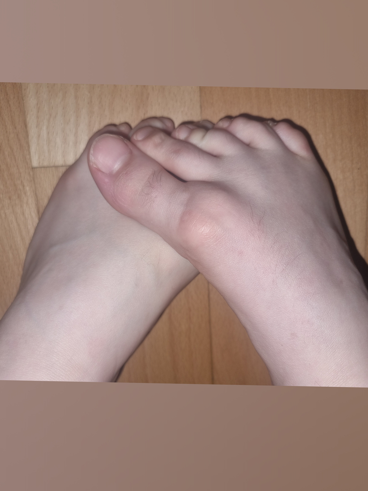 AmazingFeet cover image