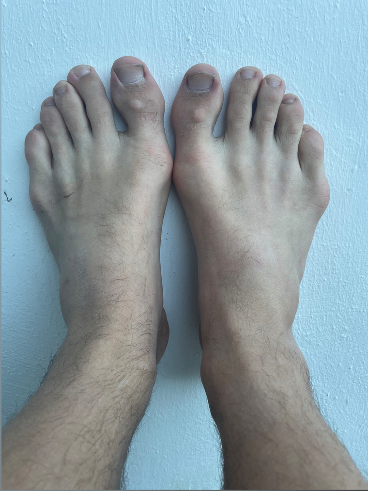Sweetfeet cover image