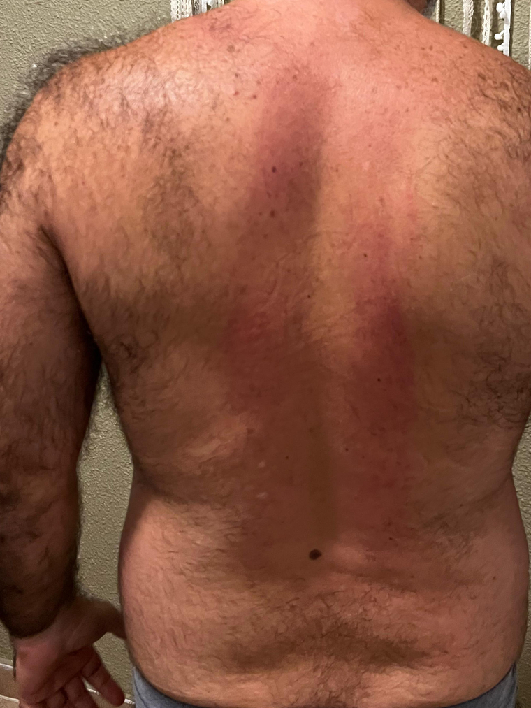 Peludoso cover image
