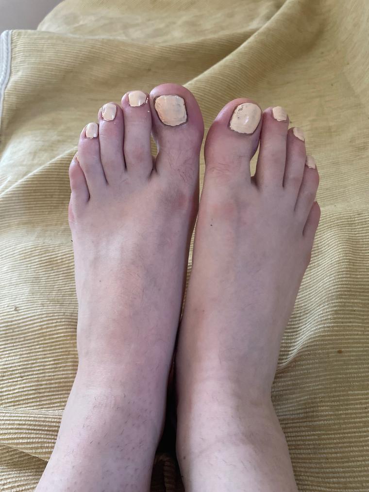 Bigloofeets cover image
