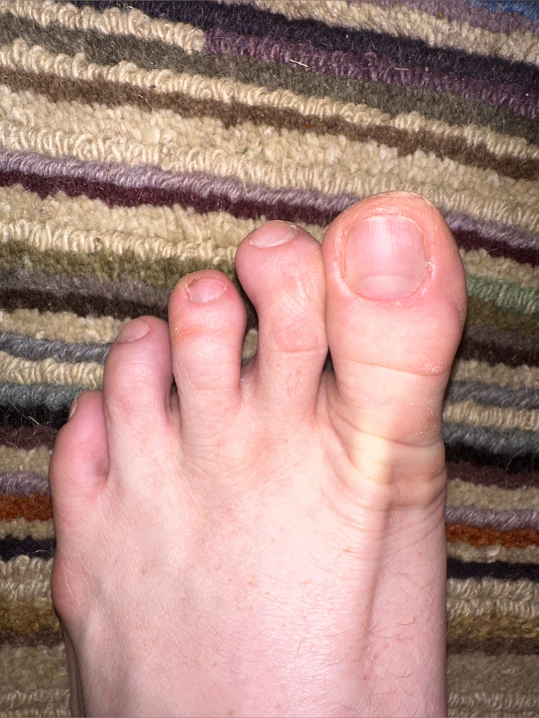 toes4u cover image