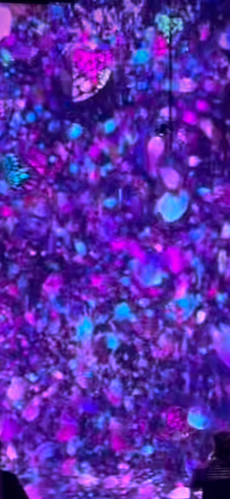 aina cover image
