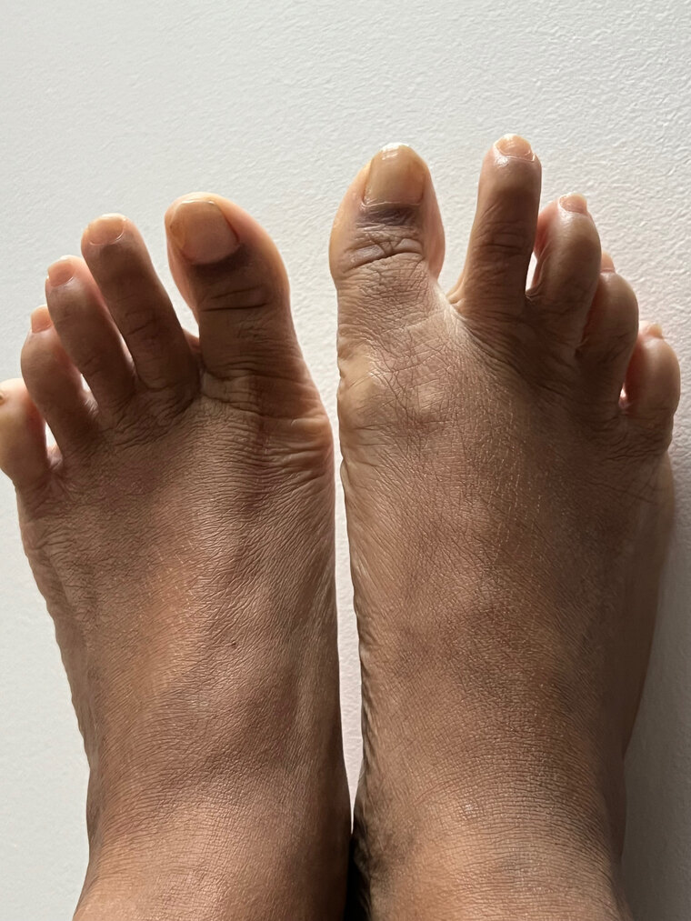 Ugly feet cover image