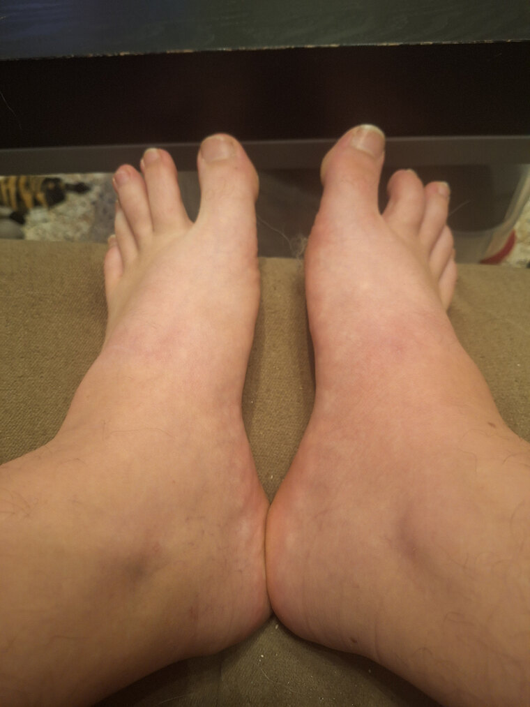 Alexfeet cover image