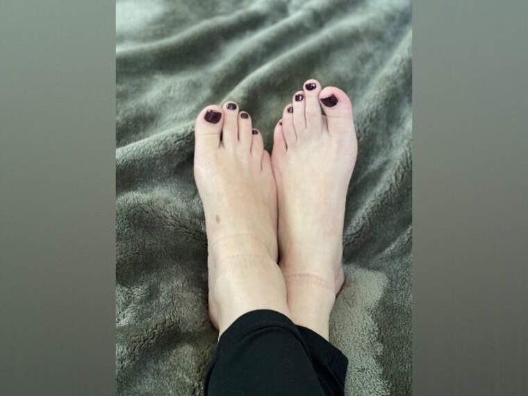 RunnerFeet cover image