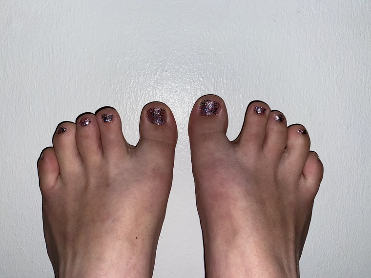 ✨🦶🏻Emma’s Wide Feet 🦶🏻✨ banner image