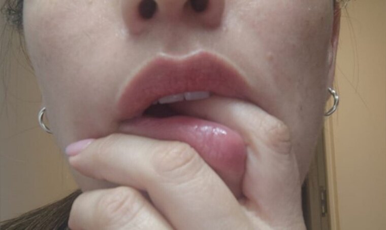 Moonlight Lips cover image