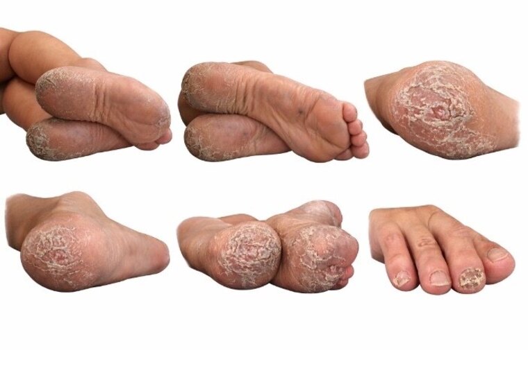 GrossSolesDownUnder banner image