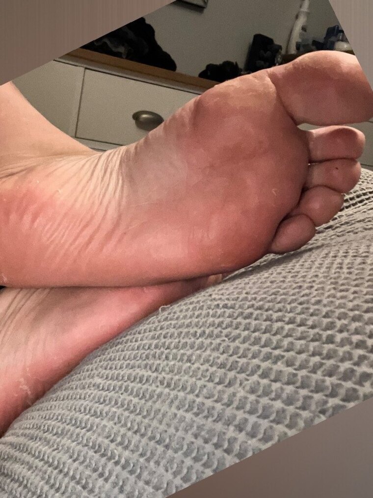 Nurses feet cover image