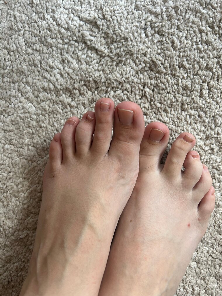 Only feet cover image