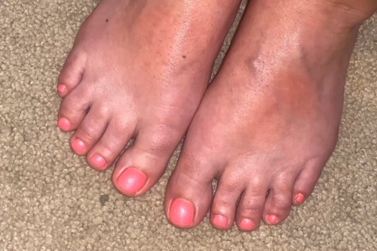PrettyFeet banner image