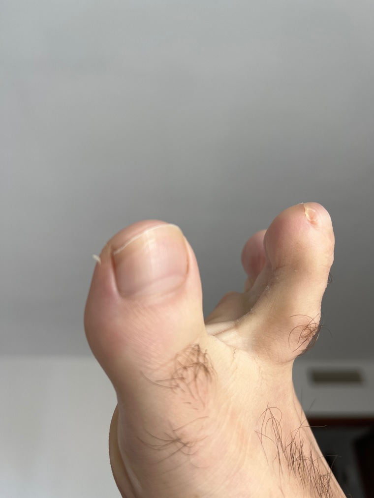 Menfeet cover image
