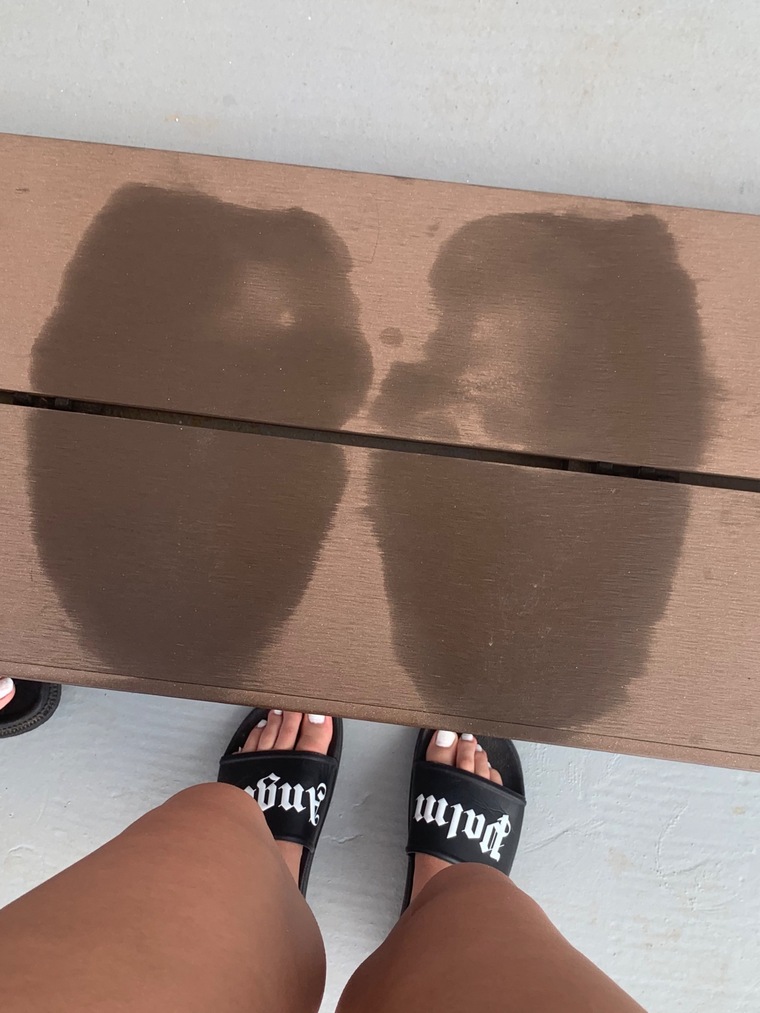 Anonymous Ugly Feet cover image
