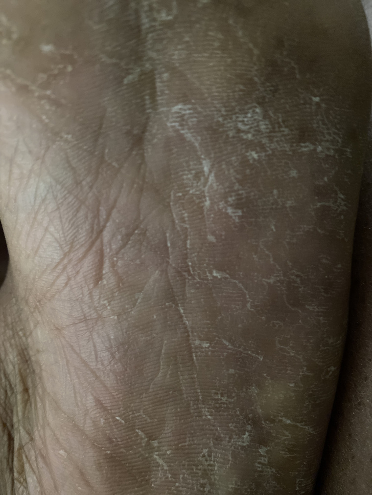 Ugly Feet cover image