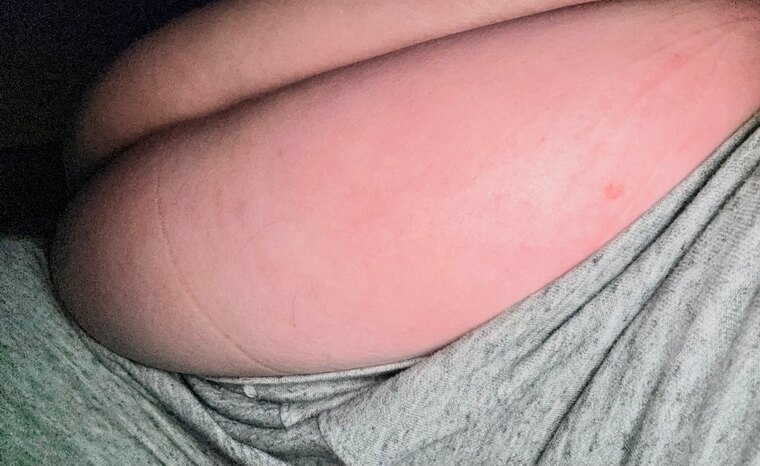 UnforgettableFUPA cover image