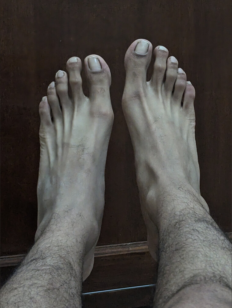 VeinyFeet Guy MX cover image