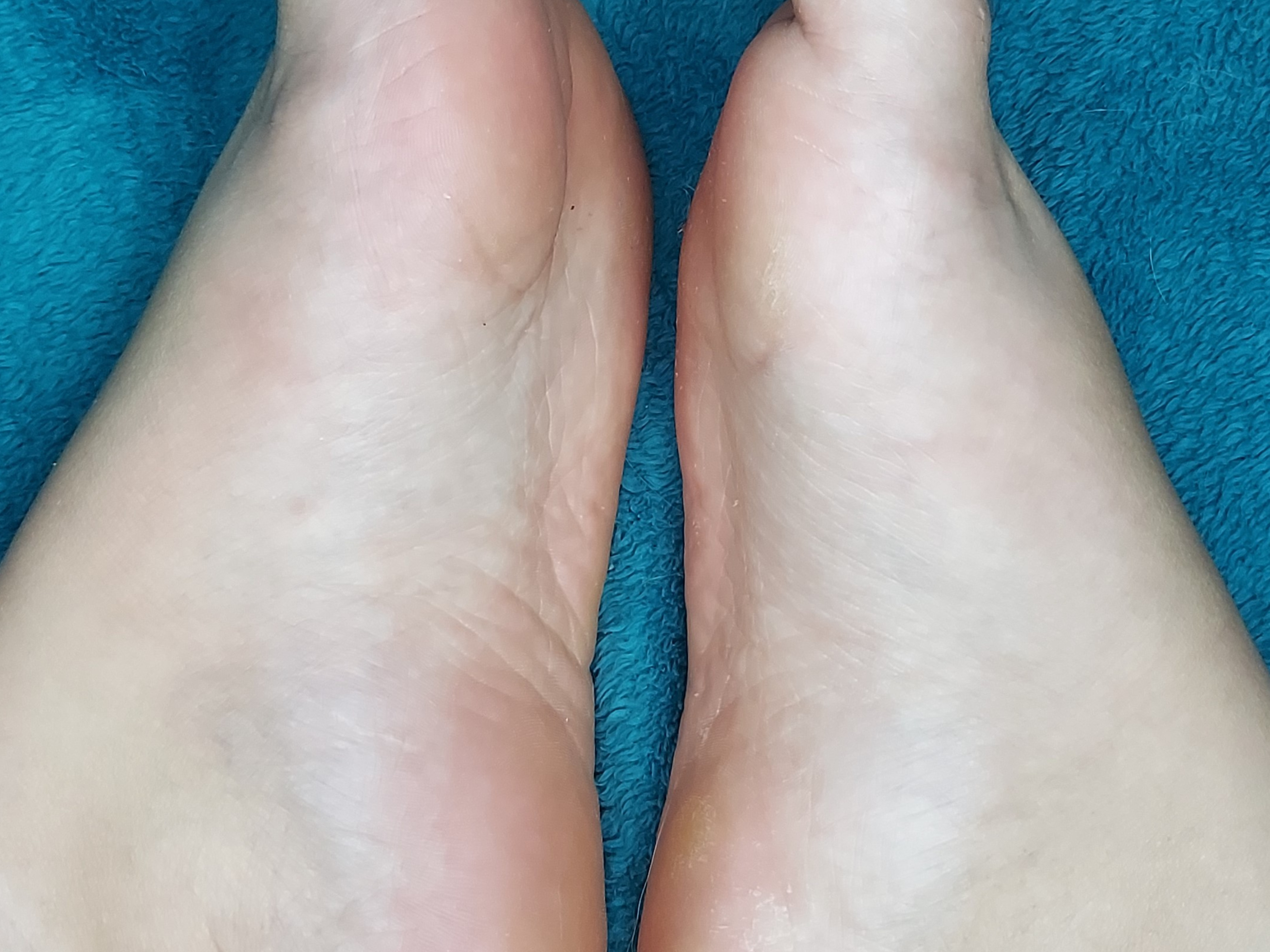 Vervainz Feet banner image