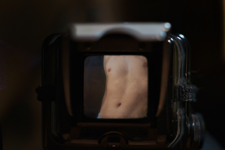 Vitiligoguy banner image