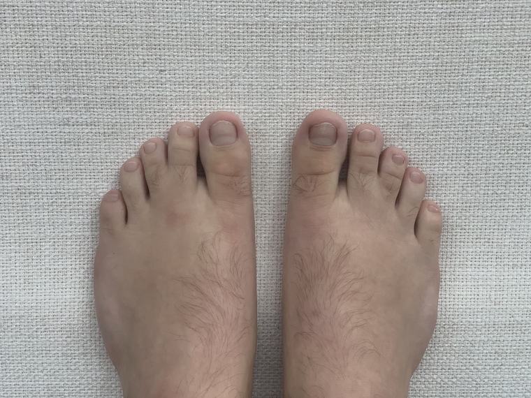 Webbed Toes Guy cover image