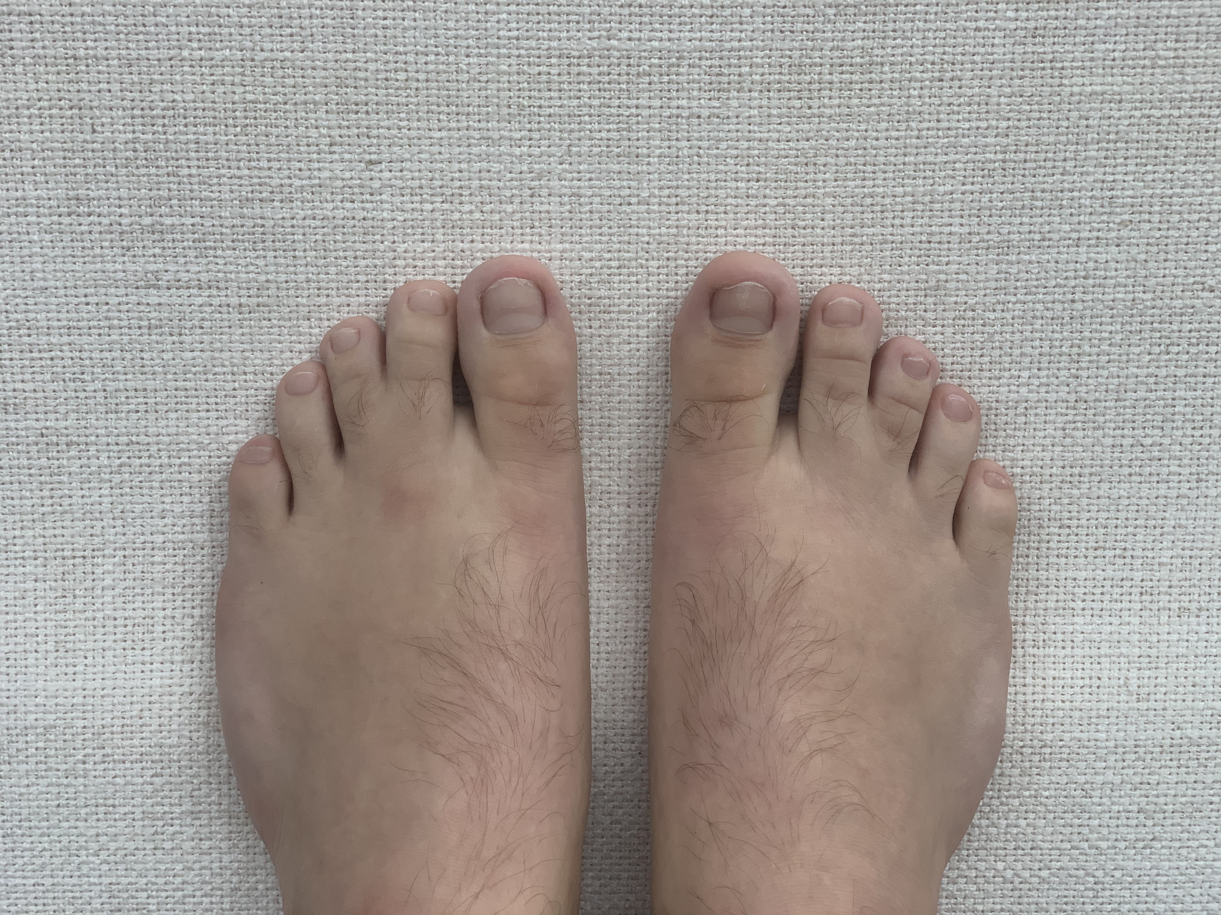 Webbed Toes Guy banner image