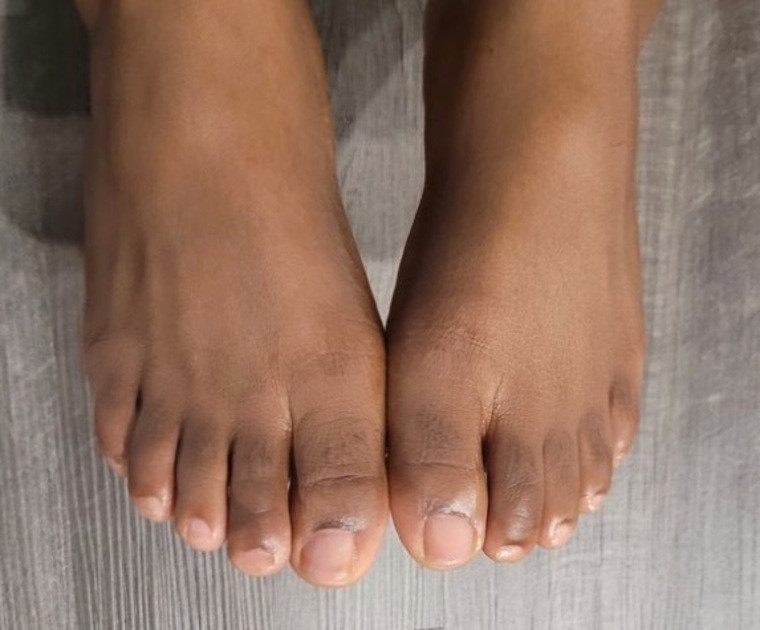 Yourevery Foots desire banner image